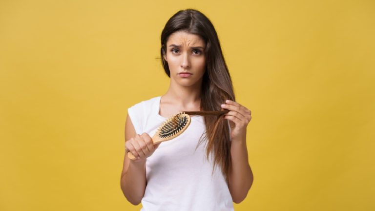 Deficiência de ferro e queda de cabelo: fatores de risco e alimentos para comer 1 Mulher com queda de cabelo devido à deficiência de ferro