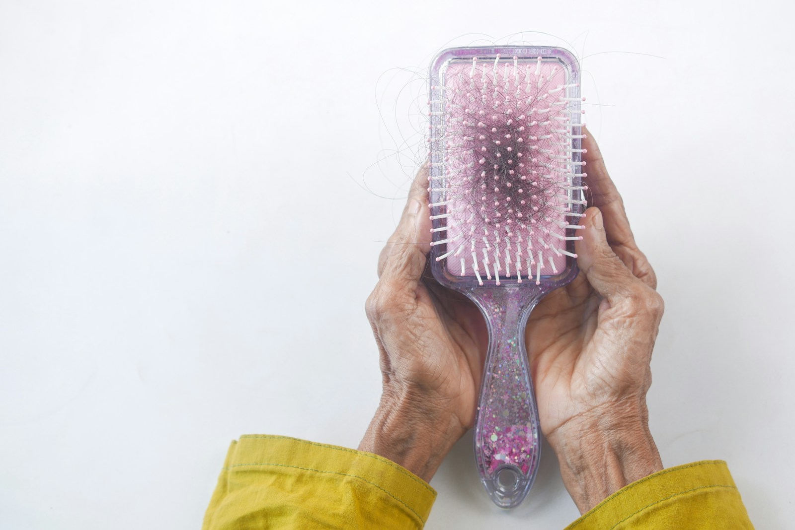 15 causas comuns de queda de cabelo que você deve conhecer 7 15 causas comuns de queda de cabelo que você deve conhecer