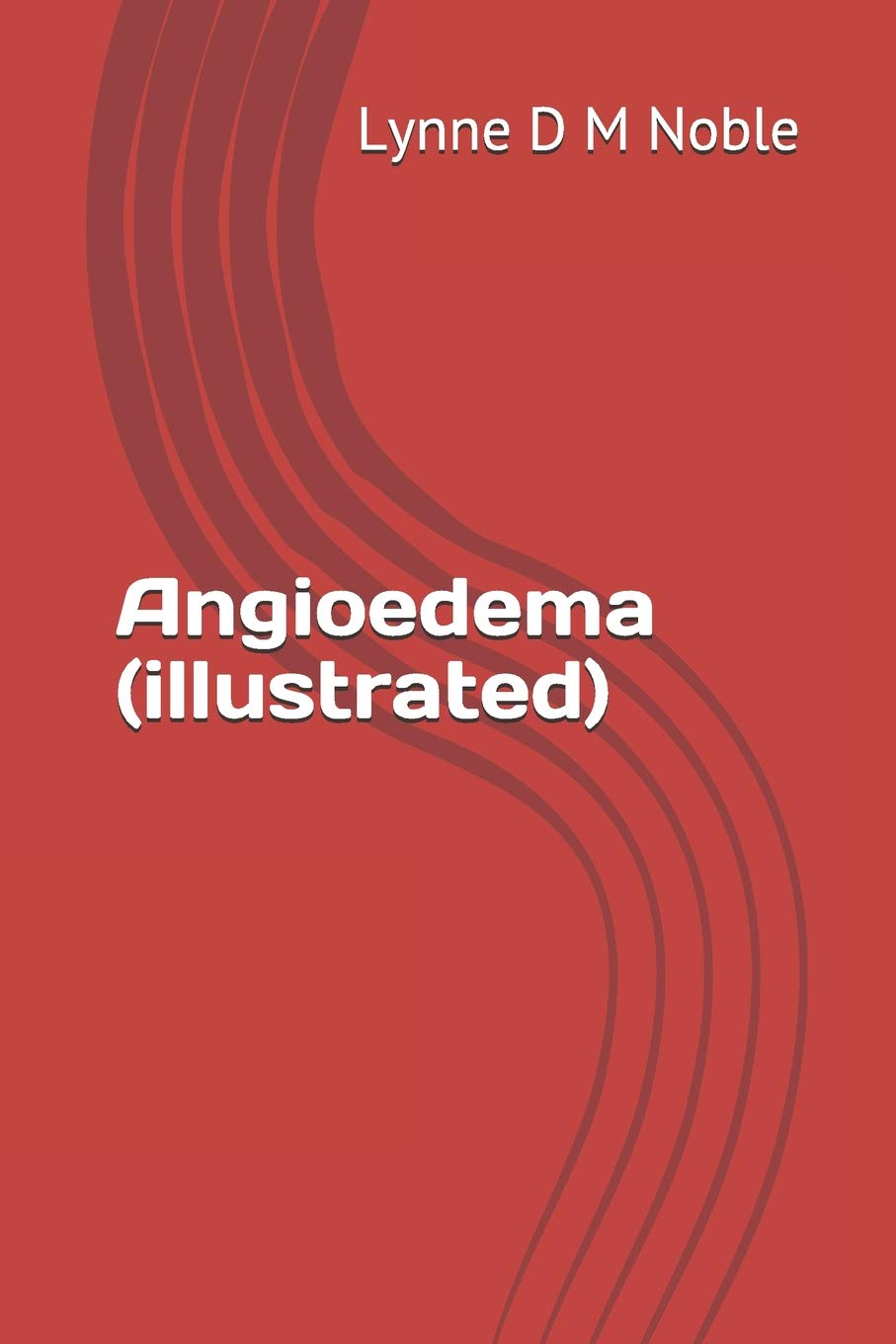 Angioedema (Illustrated)