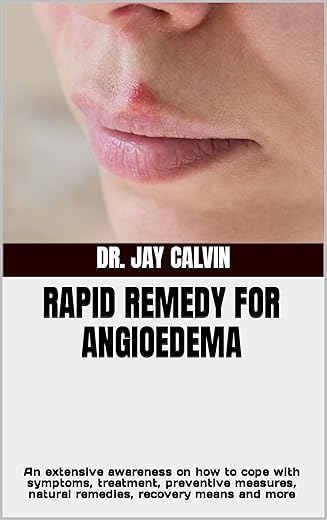 RAPID REMEDY FOR ANGIOEDEMA: An extensive awareness on how to cope with symptoms, treatment, preventive measures, natural remedies, recovery means and more (English Edition)