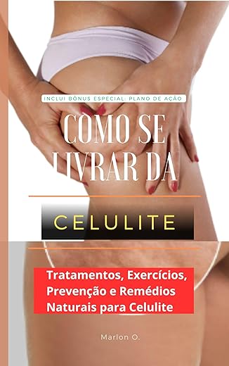 Guia Prático para Prevenção e Tratamento da Celulite: Métodos Naturais e Produtos Eficazes: Bônus Especial: Plano de Ação para Potencializar Seus Resultados