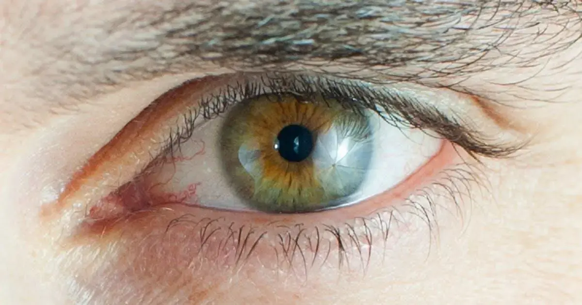 Como é feita a micropigmentação de sobrancelhas