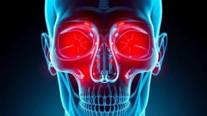 Sinusite: Sinais de agravamento que você precisa conhecer!