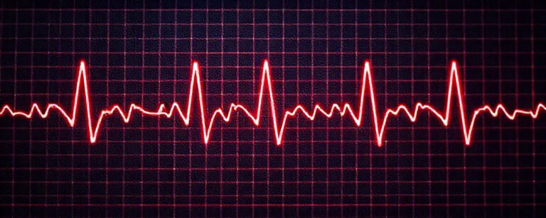 Governador Ronaldo Caiado passa por ablação após diagnóstico de arritmia 5 Eletrocardiograma