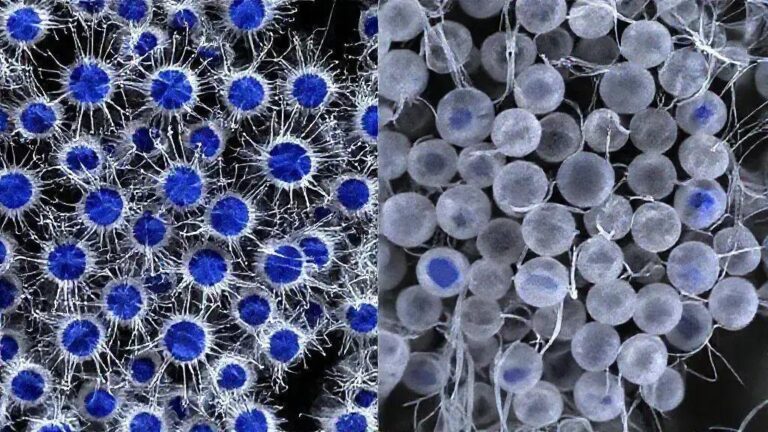 Avanços no tratamento do neuroblastoma e novas esperanças para crianças