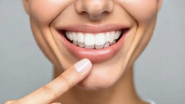 Causas e cuidados para prevenir a erosão dentária