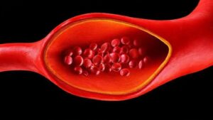 Como Cuidar das Artérias e Prevenir Doenças Cardiovasculares