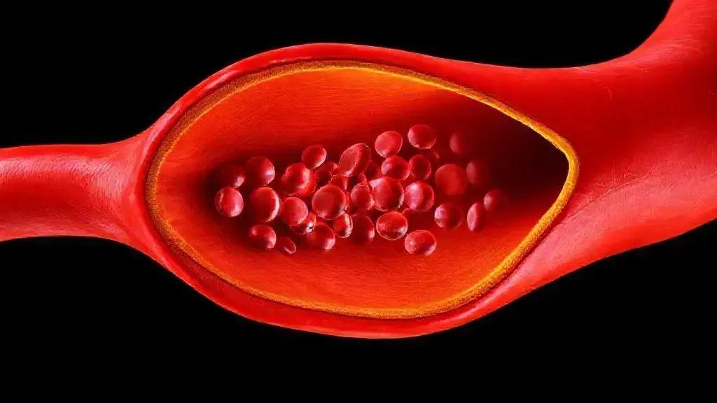 Como Cuidar das Artérias e Prevenir Doenças Cardiovasculares
