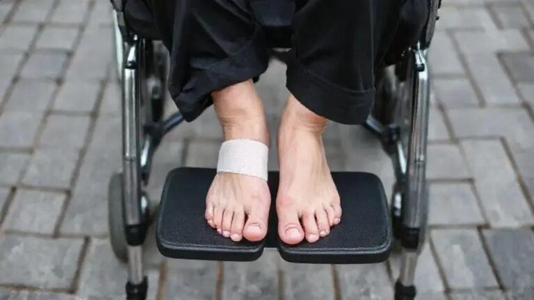 Terapia fotodinâmica: uma nova esperança no tratamento de úlceras diabéticas 7 Terapia fotodinâmica: uma nova esperança no tratamento de úlceras diabéticas