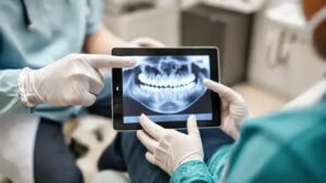 Perda acelerada de dentes aumenta risco de morte em idosos, revela estudo