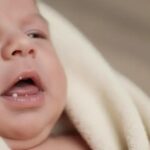 O que são as pérolas de Epstein e como identificá-las em recém-nascidos