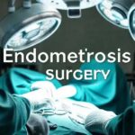 Cirurgia de endometriose: quando e como é indicada?